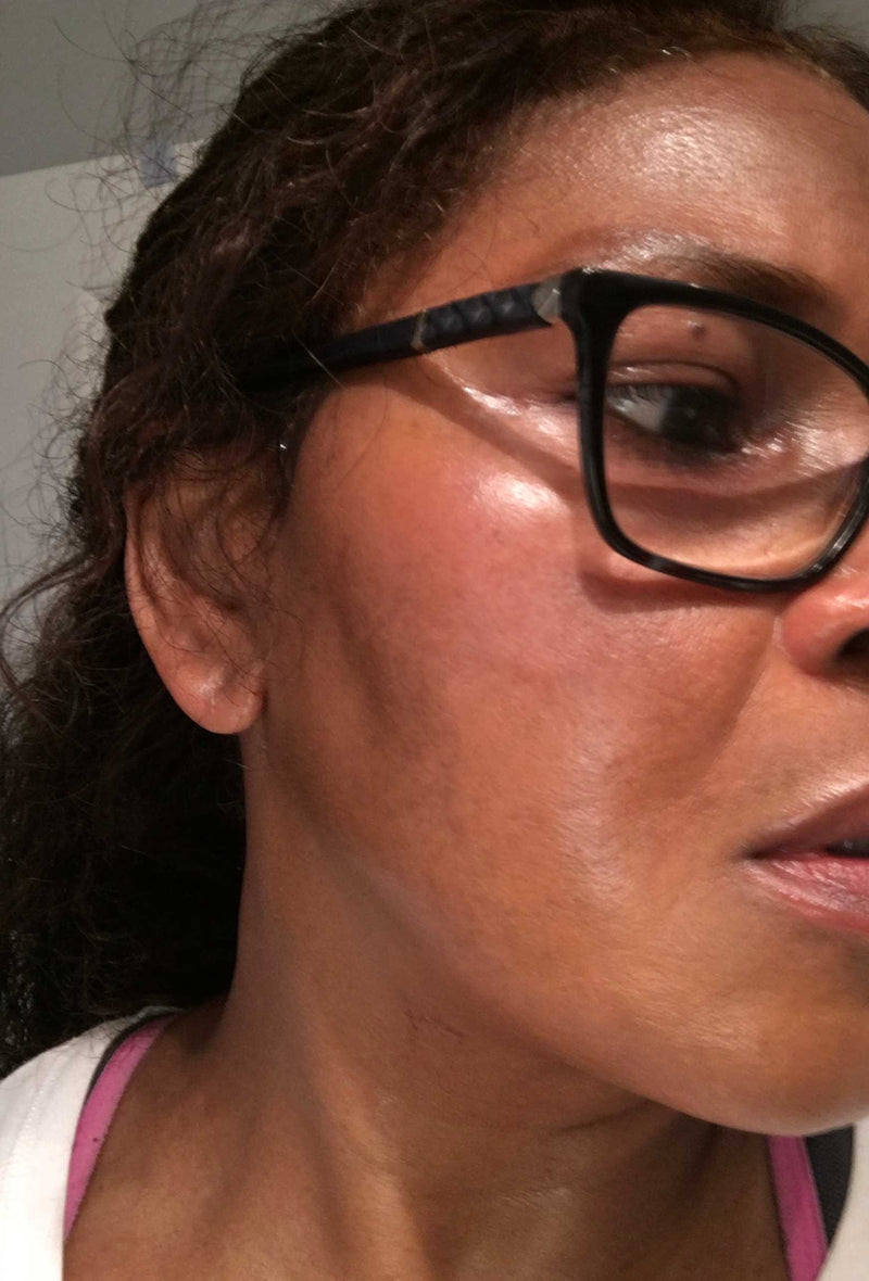 Registro após 6 semanas de uso — Jessica Pereira